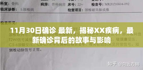 揭秘XX疾病最新确诊背后的故事与影响，11月30日最新报道