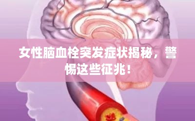 女性脑血栓突发症状揭秘，警惕这些征兆！