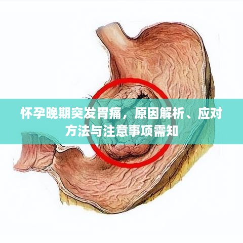 怀孕晚期突发胃痛，原因解析、应对方法与注意事项需知